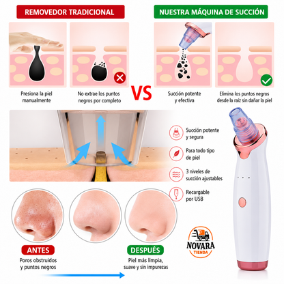 PoreLux Pro™ Limpiador de punto negros